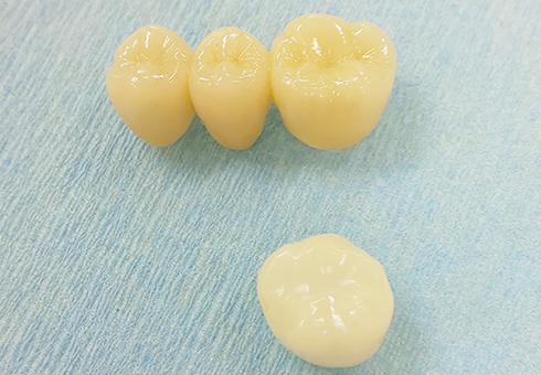 ジルコニアクラウン